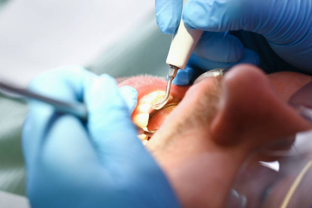 Best Pediatric Emergency Dentist in Garrettsville, OH